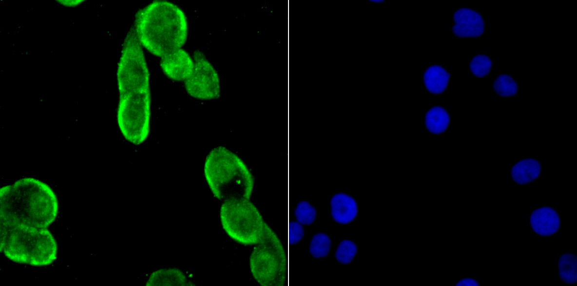 Drosha Rabbit mAb