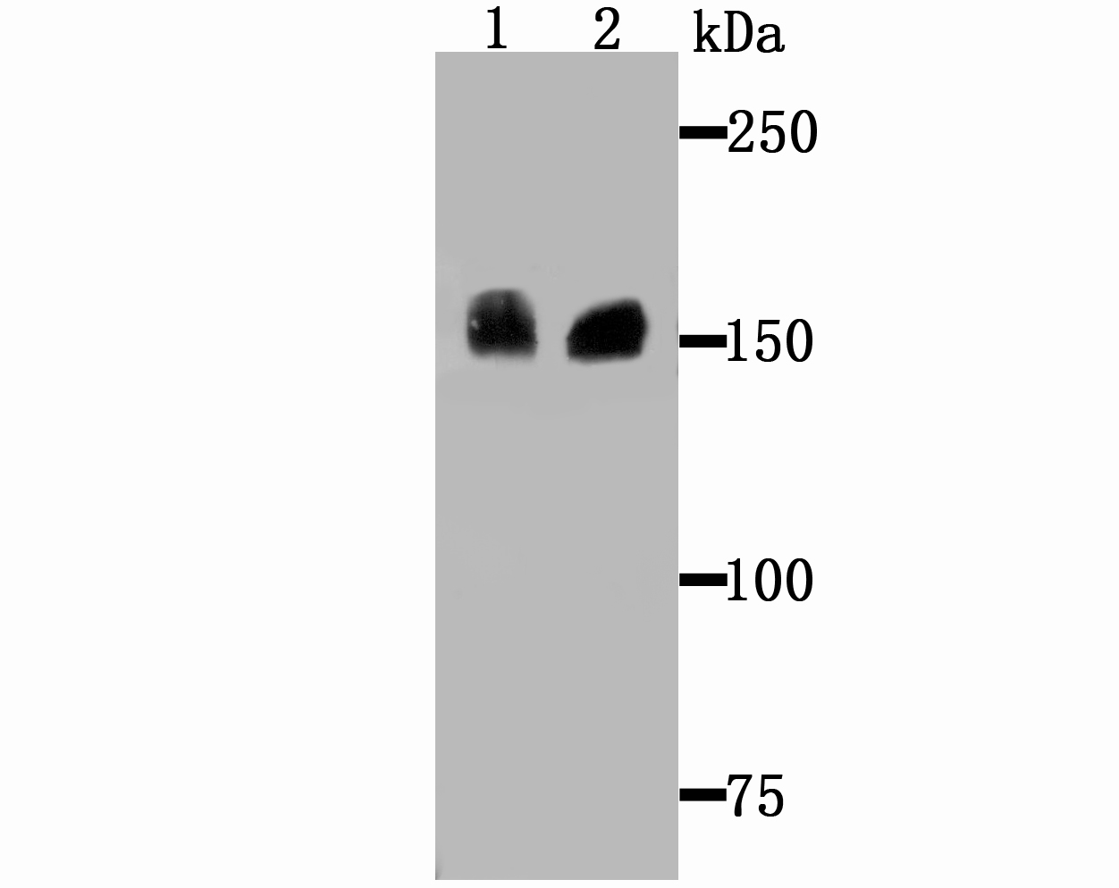 Drosha Rabbit mAb