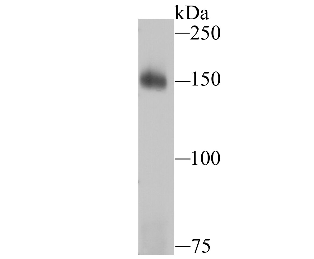 Drosha Rabbit mAb