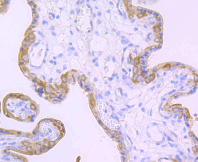 Transglutaminase 2 Rabbit mAb