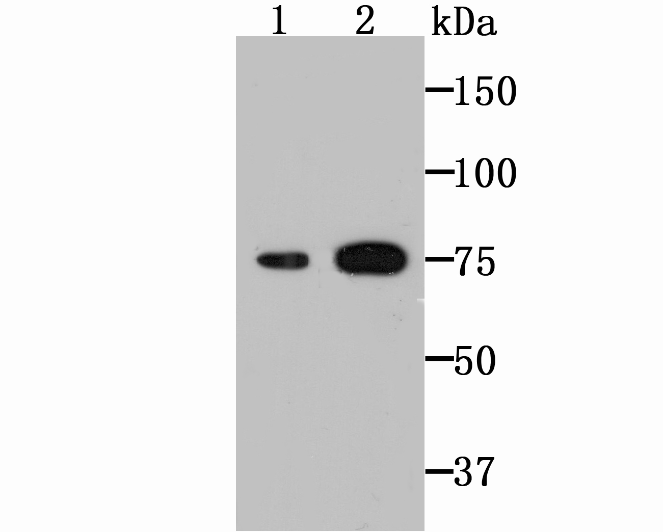 Transglutaminase 2 Rabbit mAb