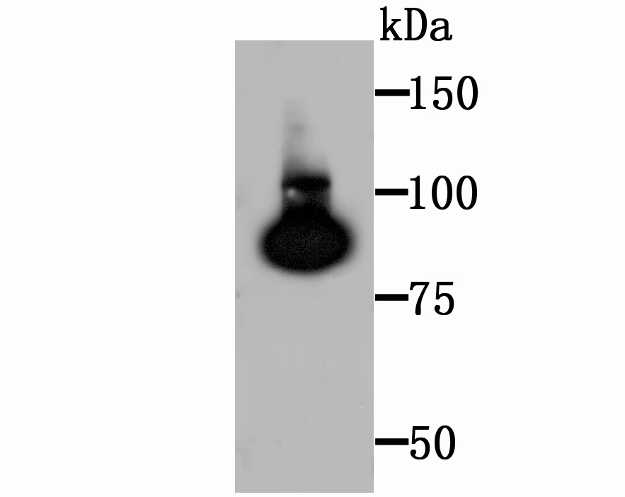 Transglutaminase 2 Rabbit mAb