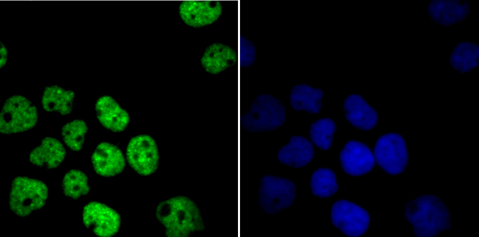 HDAC9 Rabbit mAb