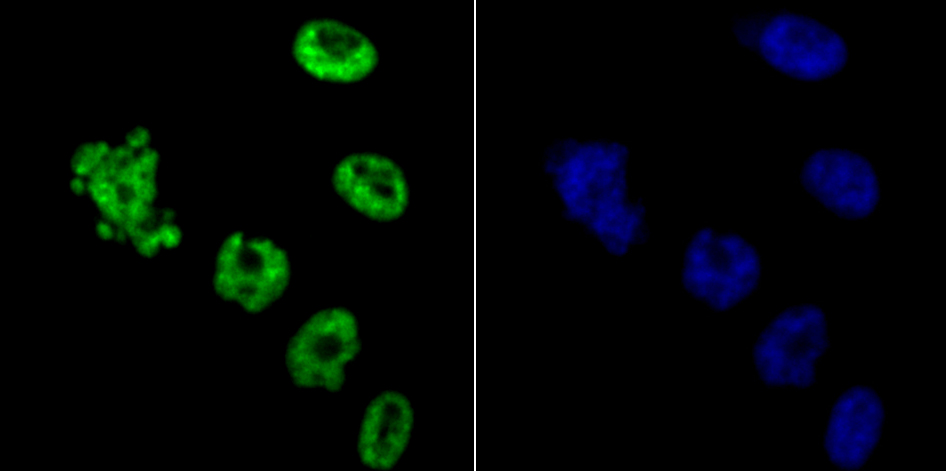 HDAC9 Rabbit mAb