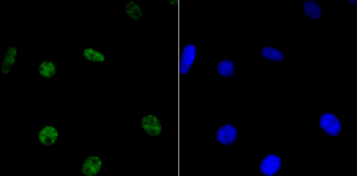 HDAC9 Rabbit mAb