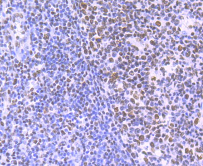 HDAC9 Rabbit mAb