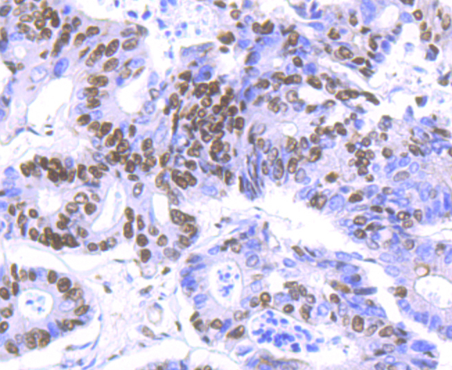 HDAC9 Rabbit mAb