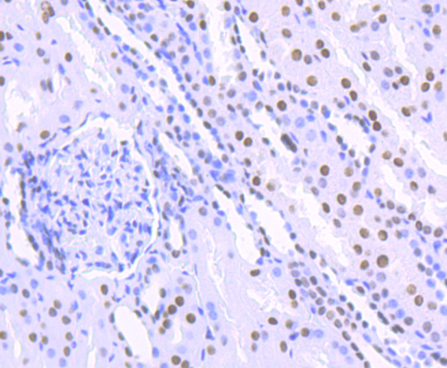 HDAC9 Rabbit mAb