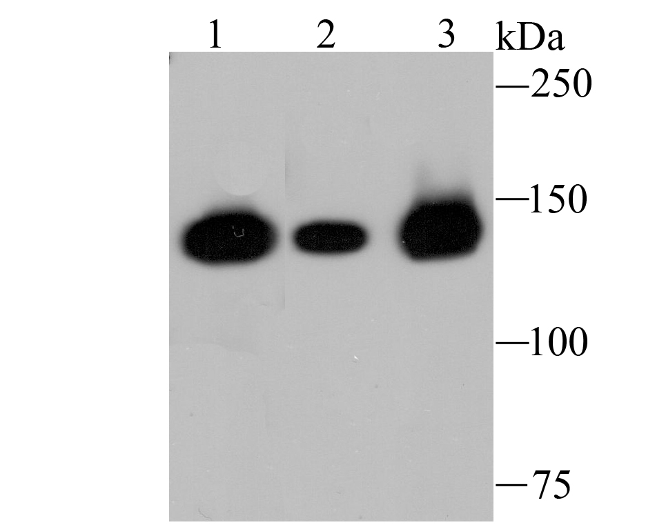 HDAC9 Rabbit mAb