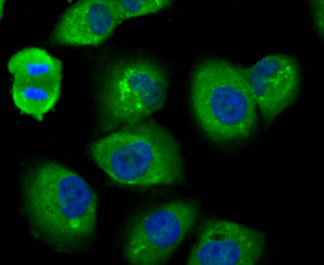 Usp14 Rabbit mAb