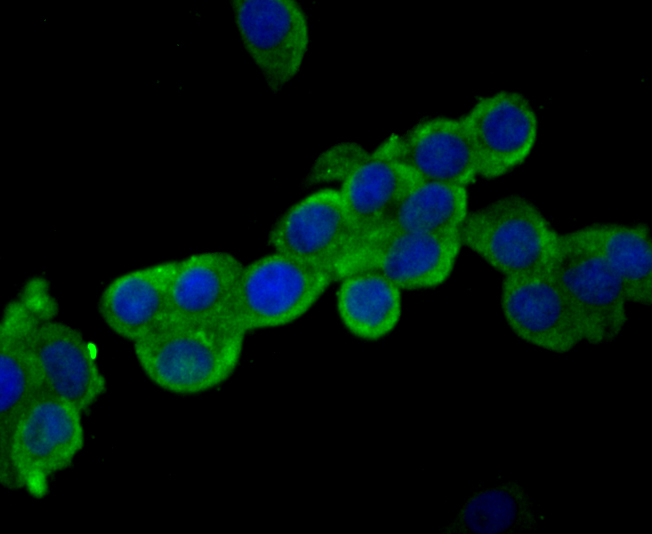 Usp14 Rabbit mAb