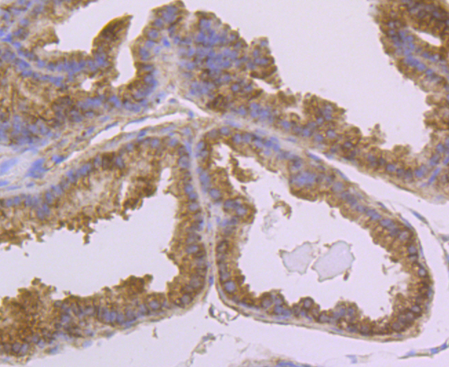 Usp14 Rabbit mAb