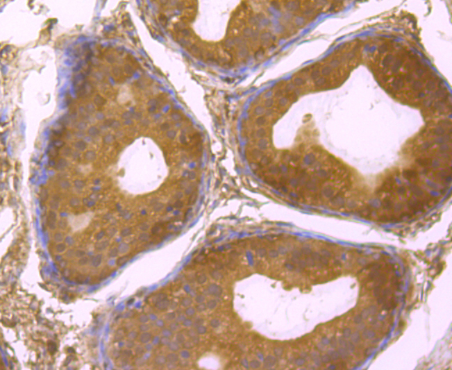 Usp14 Rabbit mAb