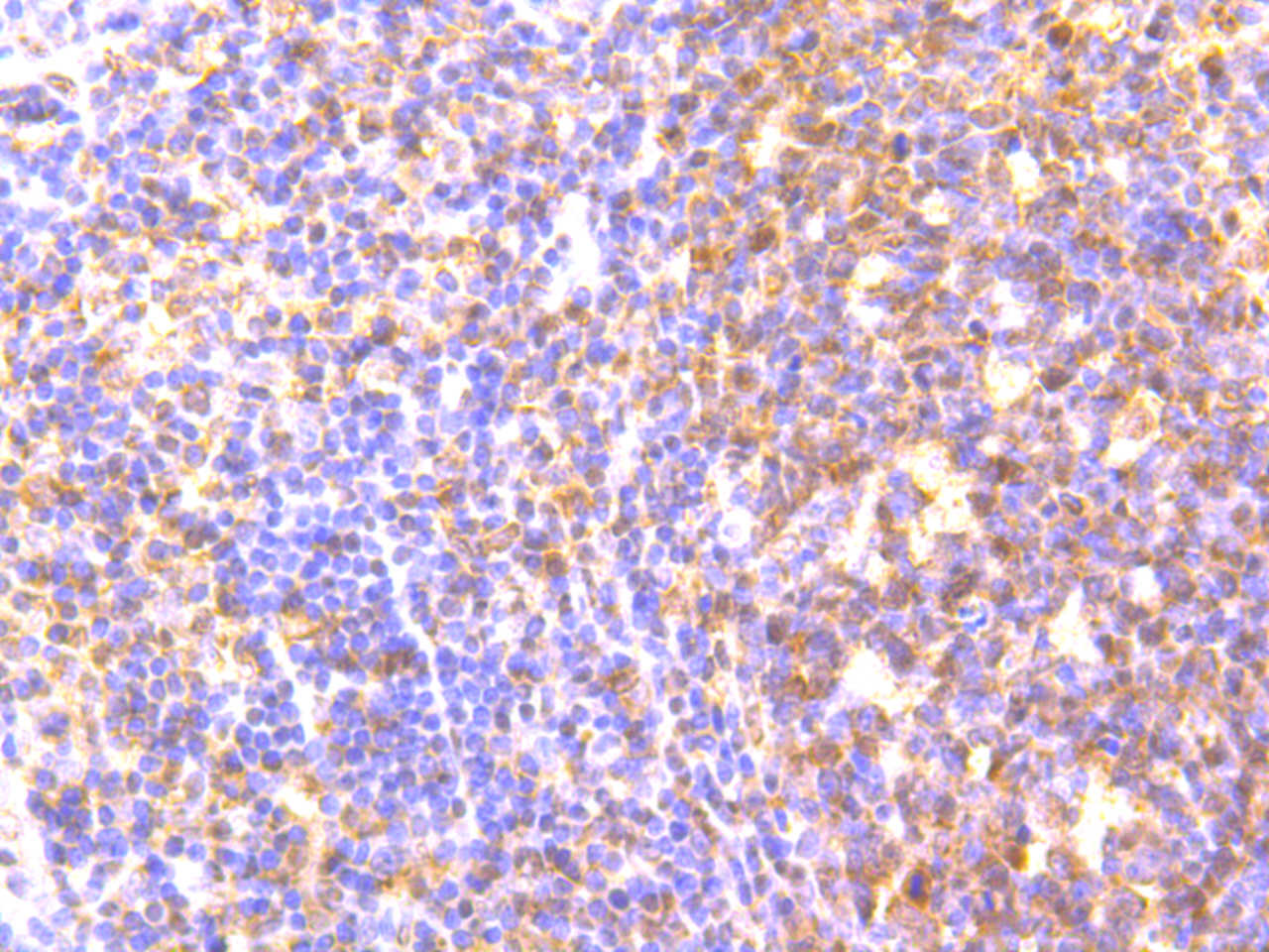 Mad2L2 Rabbit mAb