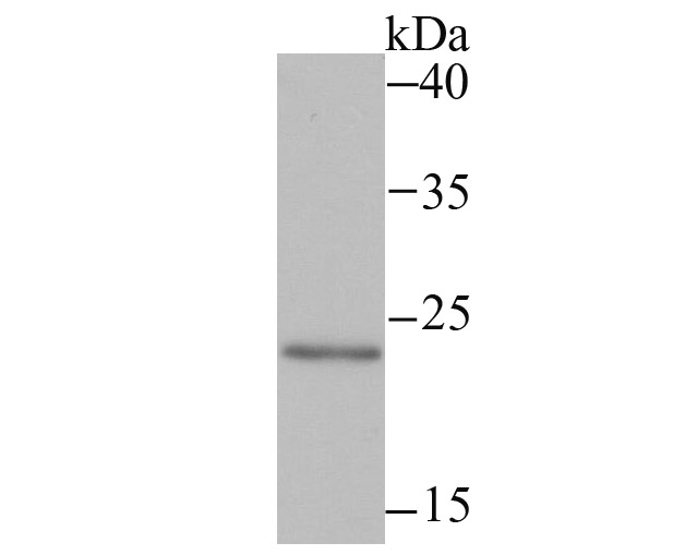 Mad2L2 Rabbit mAb