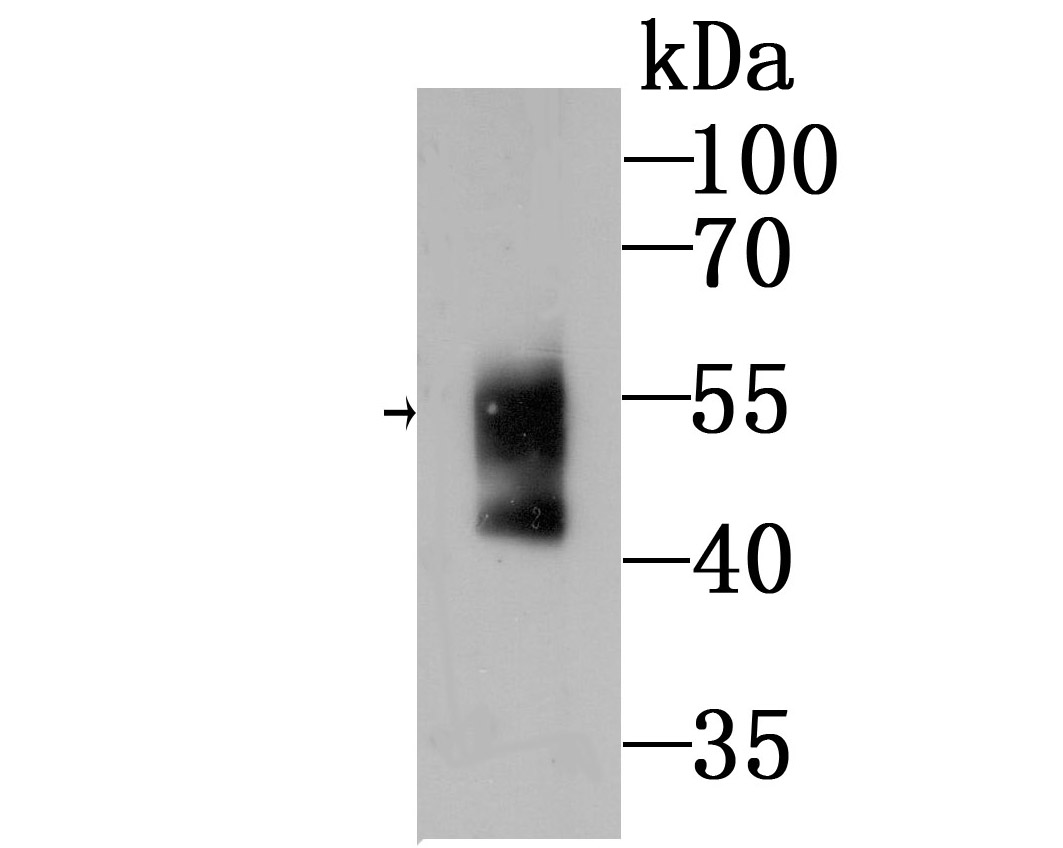 WASL Rabbit mAb