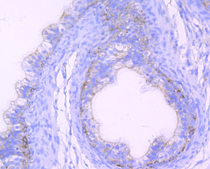 Citrate synthetase Rabbit mAb