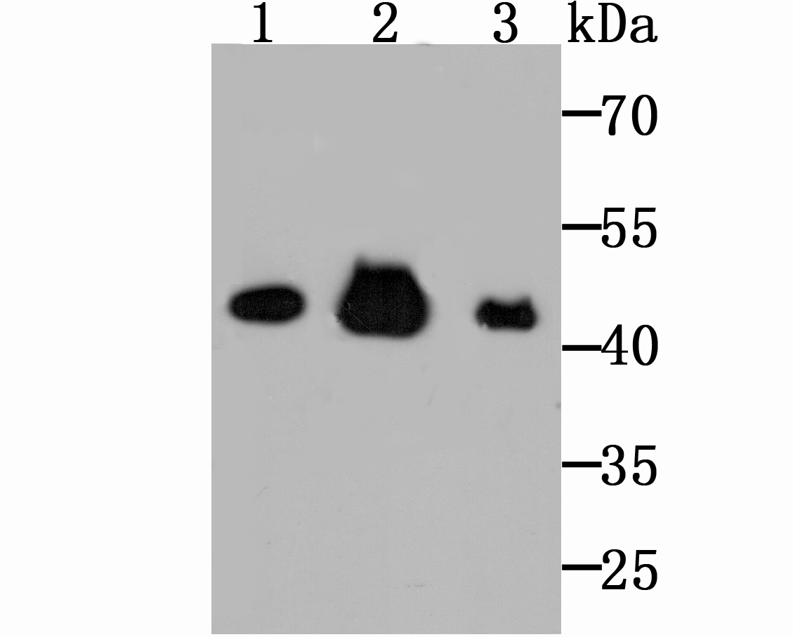 Citrate synthetase Rabbit mAb