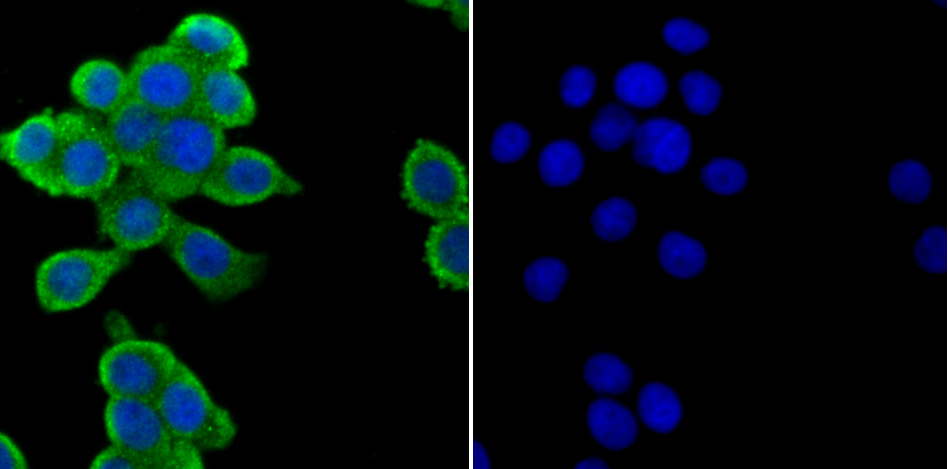 ZAP70 Rabbit mAb