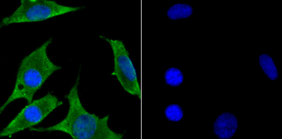 ZAP70 Rabbit mAb