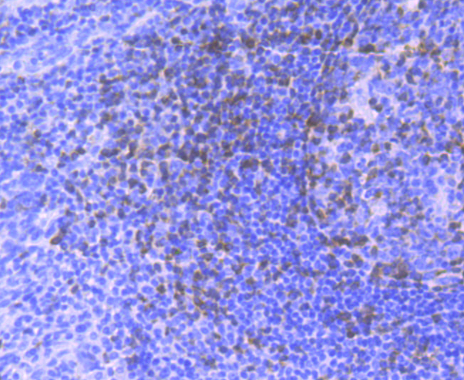 ZAP70 Rabbit mAb