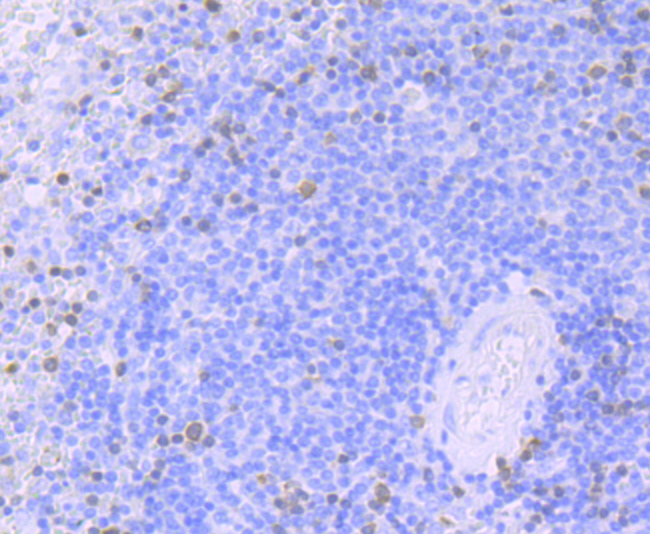 ZAP70 Rabbit mAb