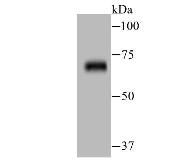 ZAP70 Rabbit mAb