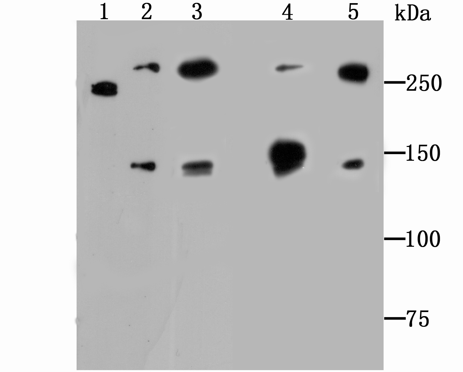 Alpha Fodrin Rabbit mAb