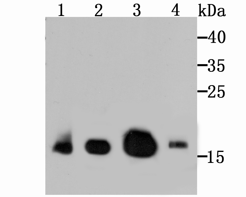 GPX4 Rabbit mAb