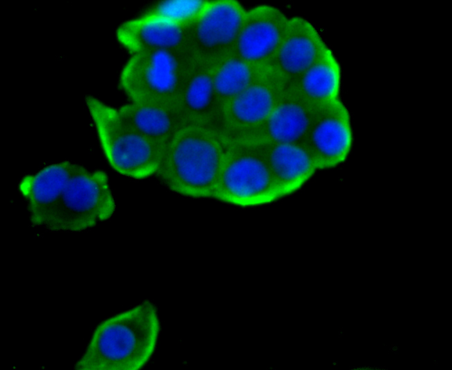 TCTP Rabbit mAb