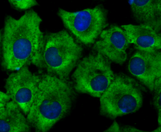 Growth hormone receptor Rabbit mAb