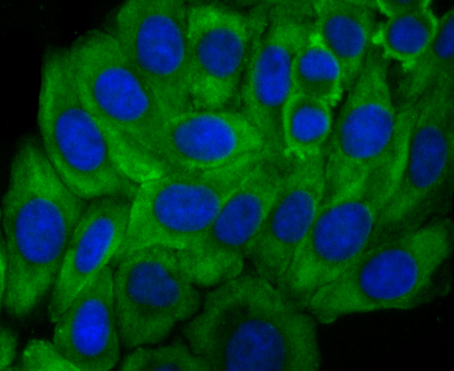 Growth hormone receptor Rabbit mAb