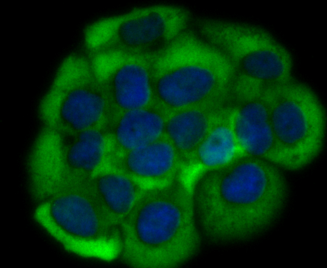 Growth hormone receptor Rabbit mAb