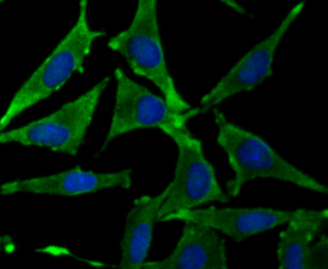 Growth hormone receptor Rabbit mAb