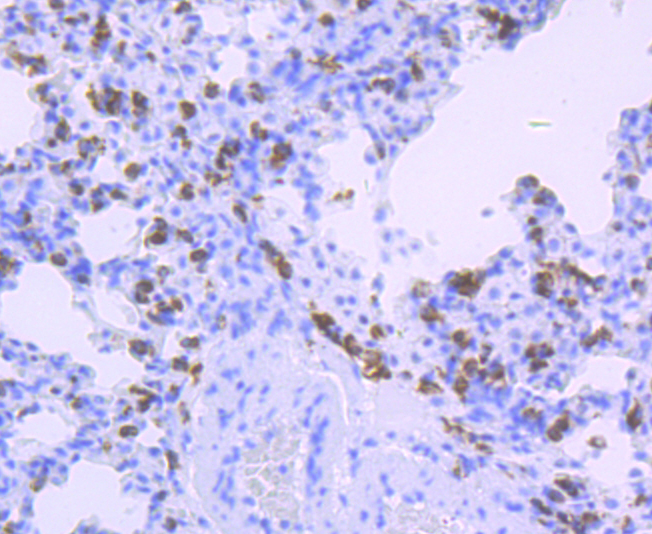 HLA-DQA1 Rabbit mAb