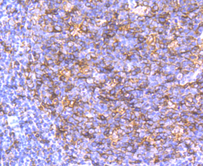 HLA-DQA1 Rabbit mAb