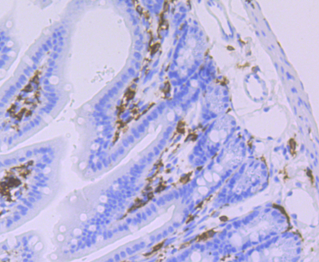 HLA-DQA1 Rabbit mAb