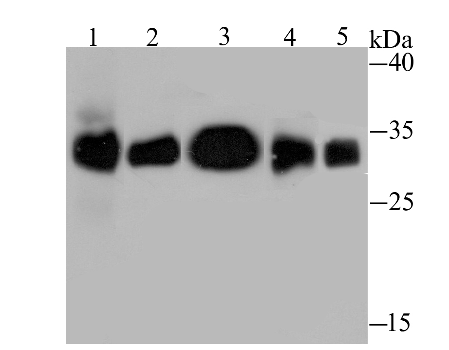 HLA-DQA1 Rabbit mAb