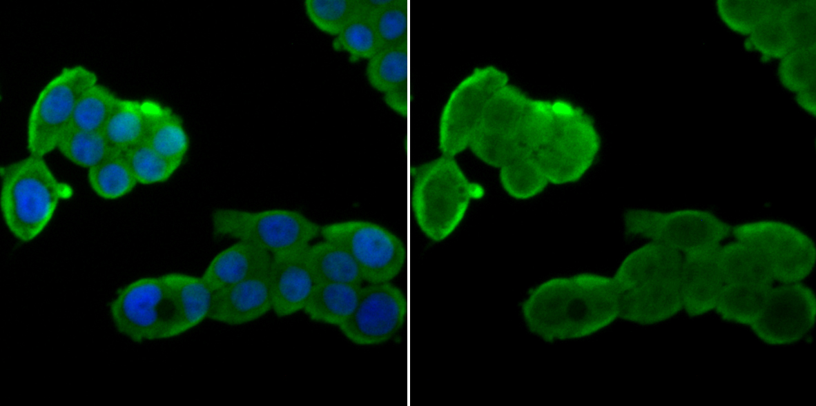 Nuclear Matrix Protein p84 Rabbit mAb