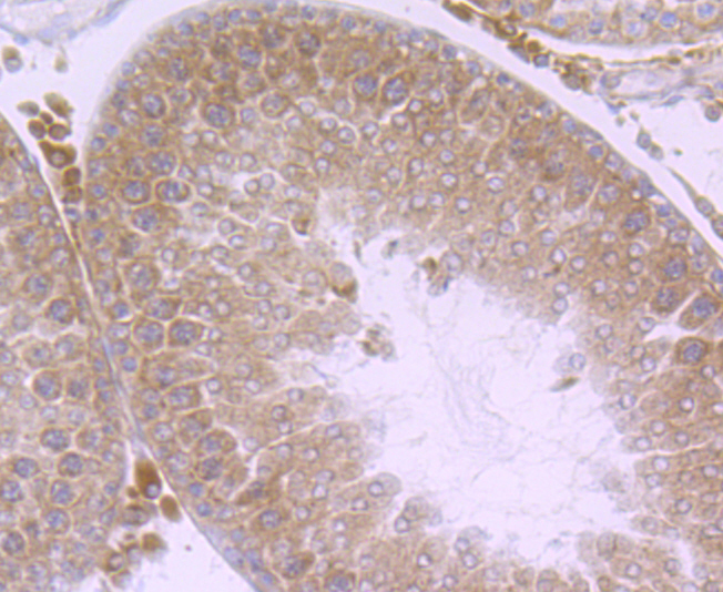 Nuclear Matrix Protein p84 Rabbit mAb