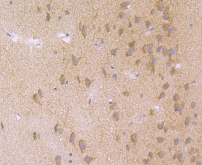 Nuclear Matrix Protein p84 Rabbit mAb