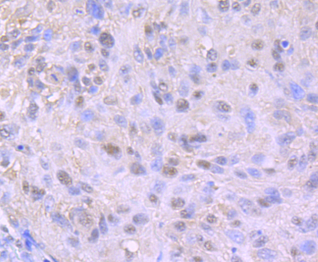 Nuclear Matrix Protein p84 Rabbit mAb