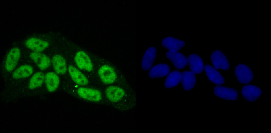 RbAP48 Rabbit mAb