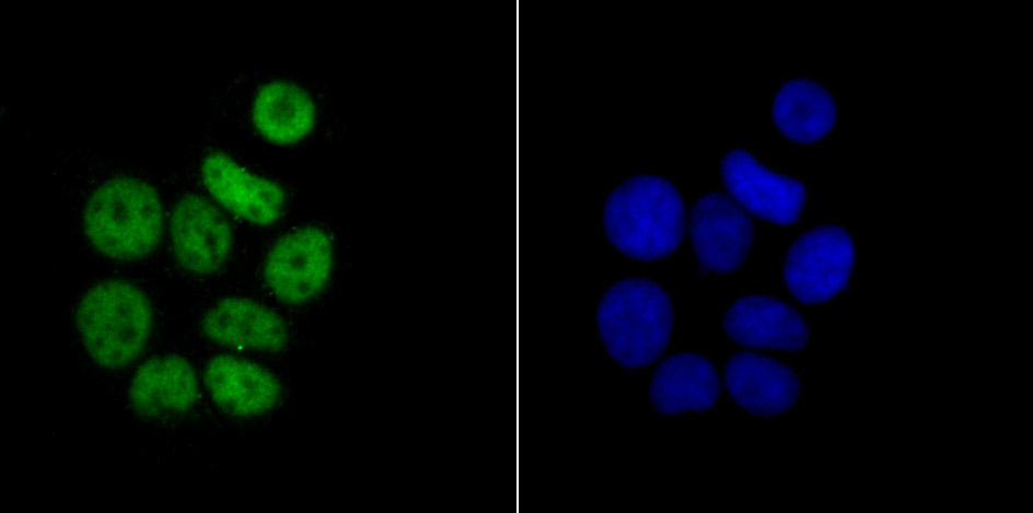 RbAP48 Rabbit mAb