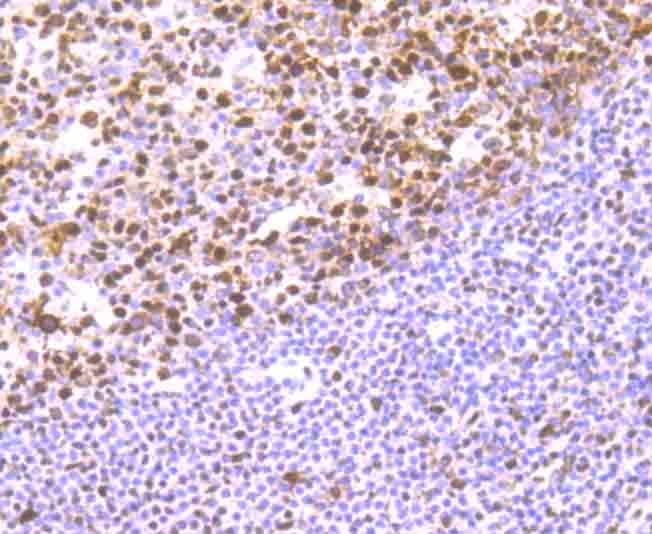 RbAP48 Rabbit mAb