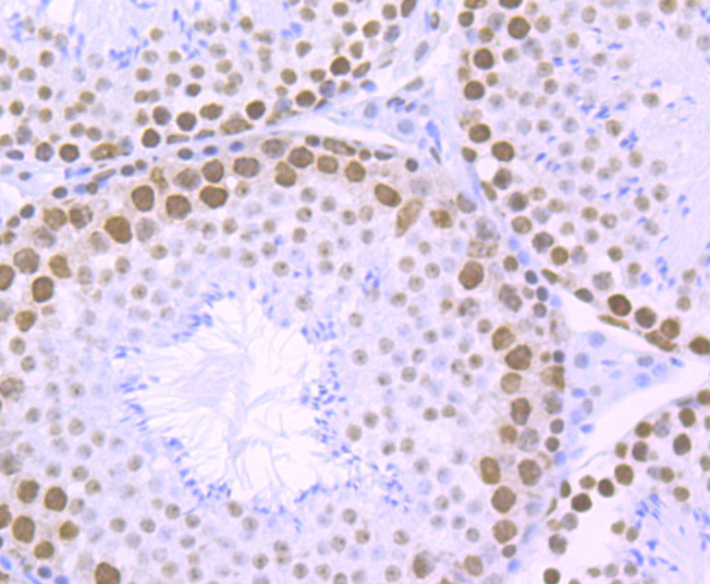 RbAP48 Rabbit mAb