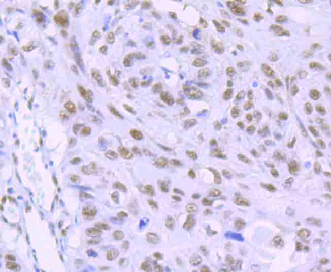 RbAP48 Rabbit mAb