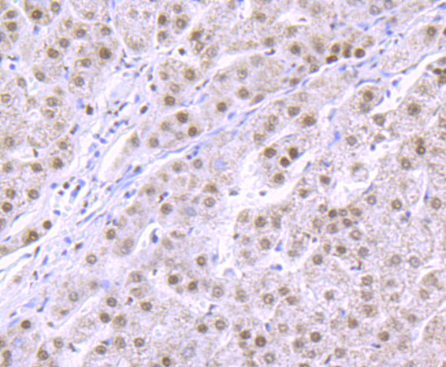 RbAP48 Rabbit mAb