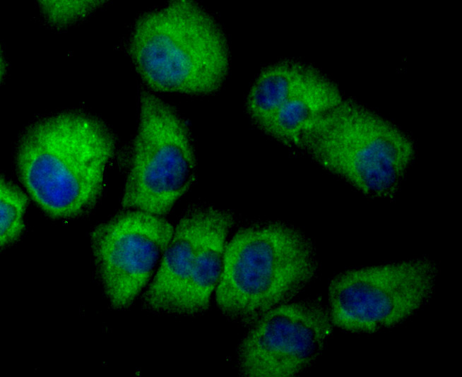 EAAT3 Rabbit mAb