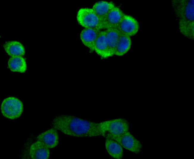 EAAT3 Rabbit mAb